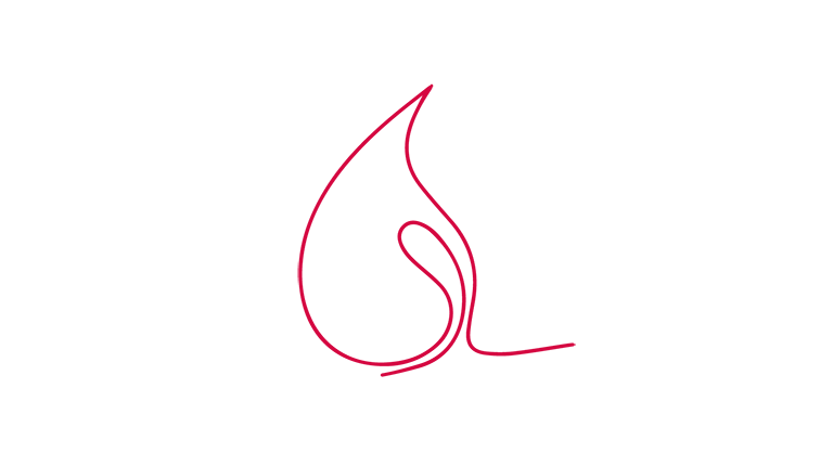 EISENMANGEL