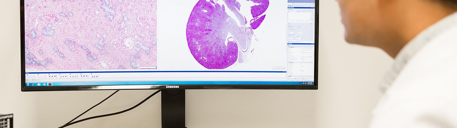 Nephrology
